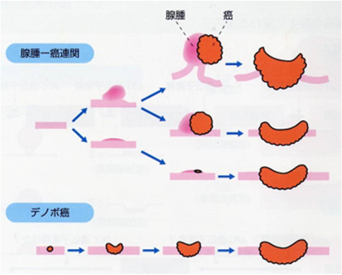 大腸がん治療ガイドラインの解説