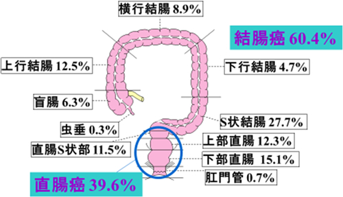 全国大腸がん登録, 1995～1996