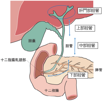 肝外胆管の分類