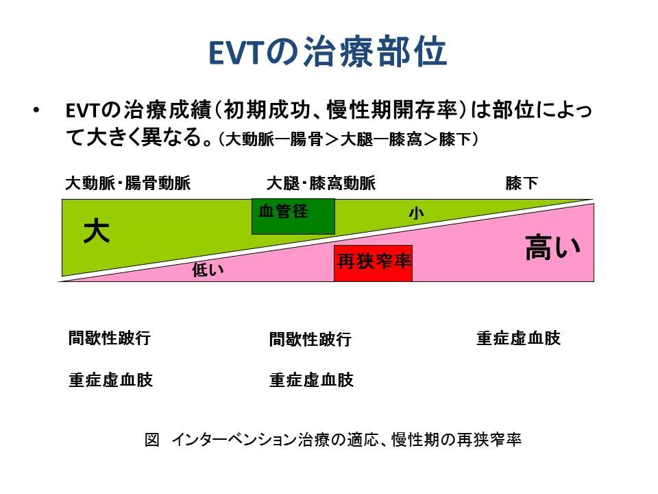 下肢PADのインターベンション