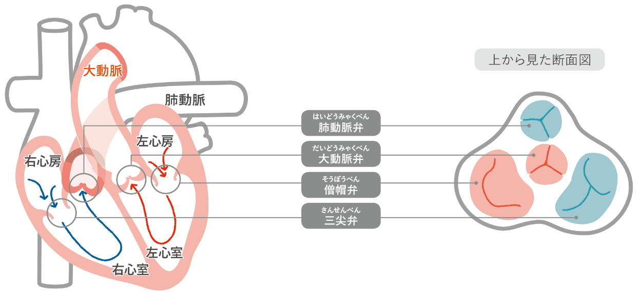 心臓弁膜症