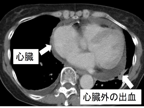 横断像