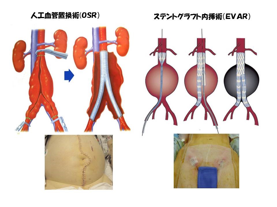 手術