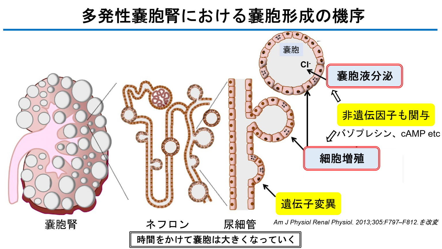 多発性嚢胞腎における嚢胞形成の機序